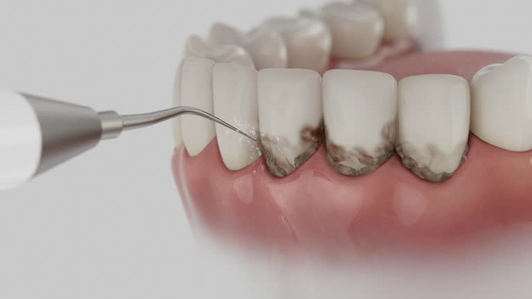 Trusted Teeth Cleaning And Checkup service in Tarpey Village, CA - Dentist Open Now